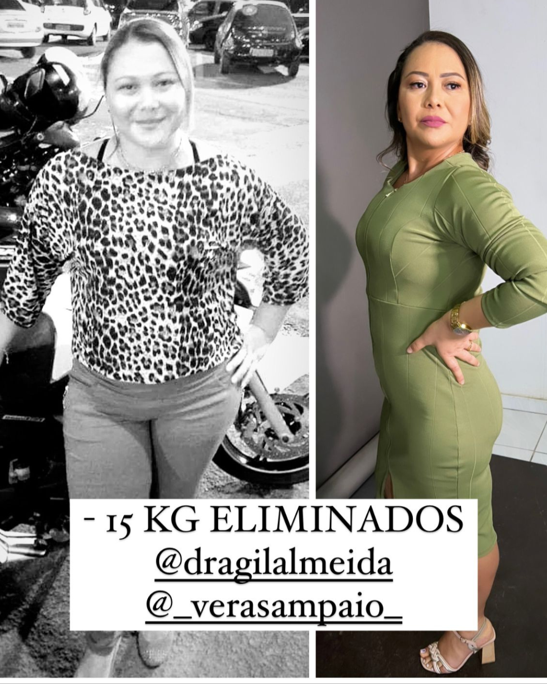 Clínica de emagrecimento da Gil